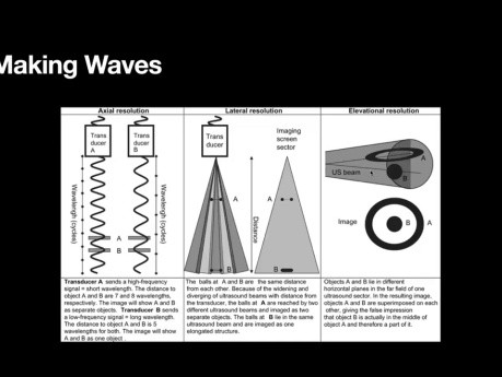 The Physics of Echocardiography; How I Learned to Love AS