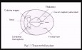 Fetal Ultrasound Guide for Beginners