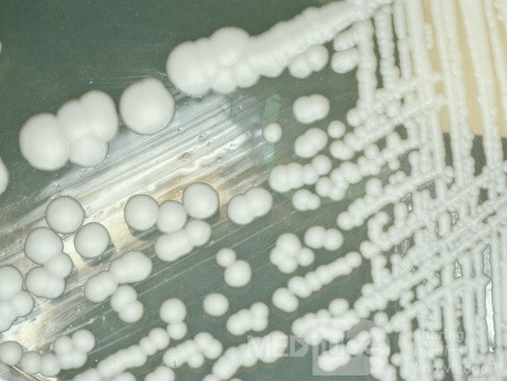 Candida Albicans Plate Culture