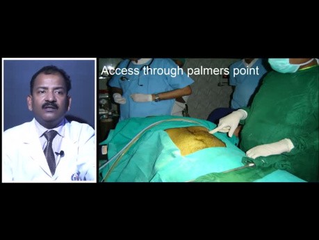 Laparoscopic Access Techniques Lecture