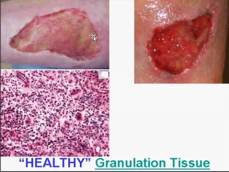 Regeneration and Healing - MSP - 3e