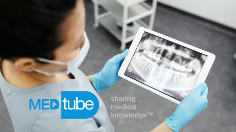 Odontogenic tumors - characteristics, diagnosis and treatment​