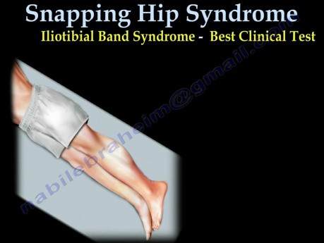 Snapping Hip Syndrome - Video Lecture