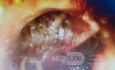 Acute Otitis Media - Endoscopy