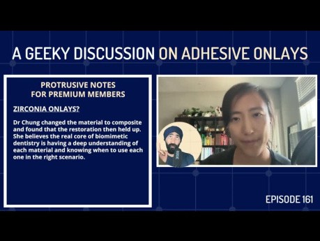 A Geeky Discussion on Adhesive Onlays