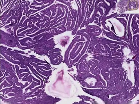 Secretory endometrium