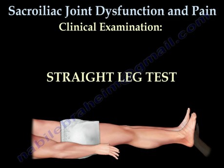 Sacroiliac Joint Dysfunction - Video Lecture