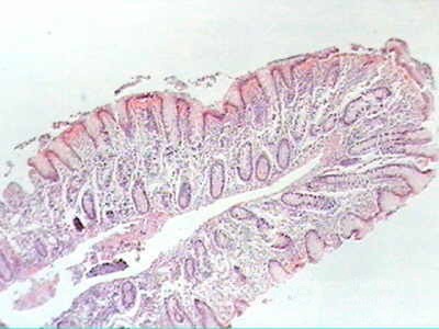 Trichuris Trichuris (whipworm) (16 of 19)