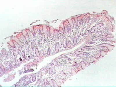 Trichuris Trichuris (whipworm) (16 of 19)