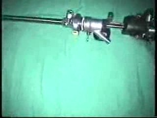 Description Of The Resection Master Resectoscope