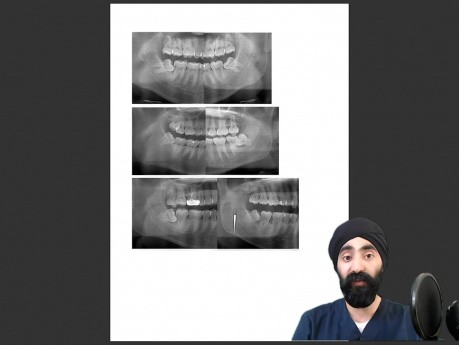Dental CVs and Portfolios - [Example Dental Portfolio]