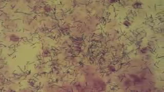 Lactobacillus acidophilus - Pap smear