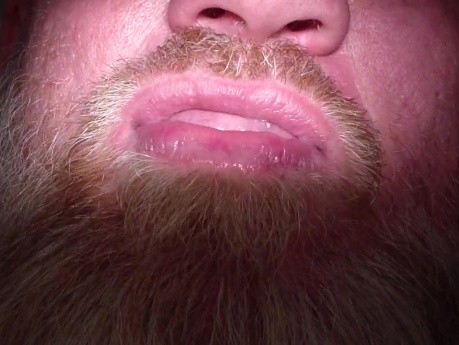 Tell Me A Joke W/ Your New Teeth