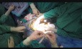 Laparoscopic Radical Cistectomy