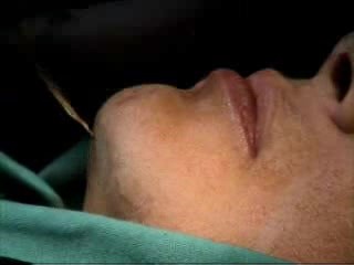 Scarless Chin Enhancement