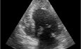 Echocardiography Quiz. Apical View. Is the Left Ventricle Normal