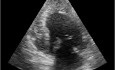 Echocardiography Quiz. Apical View. Is the Left Ventricle Normal