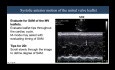 Hypertrophic Cardiomyopathy from Echo’s Perspective, Practical Pearls & Common Questions
