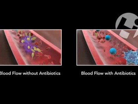 Antibiotics