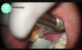How operating microscope can help us with difficult diagnosis