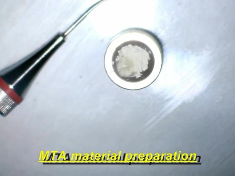 Perforation repair - using MTA