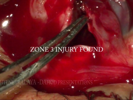 Pole to Pole Surgery