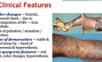 Gangrene & Diabetic Foot