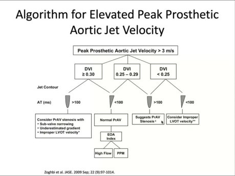 Echo Evaluation of Prosthetic Valves with High Flow Velocities