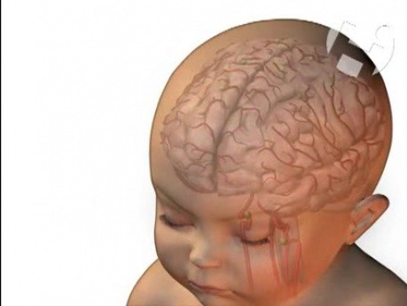Fetal Circulation and Brain Oxygenation