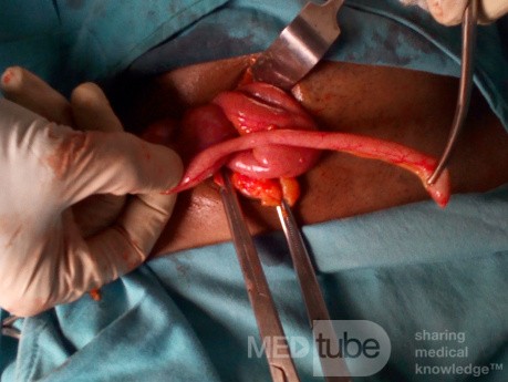 Appendix Extracted