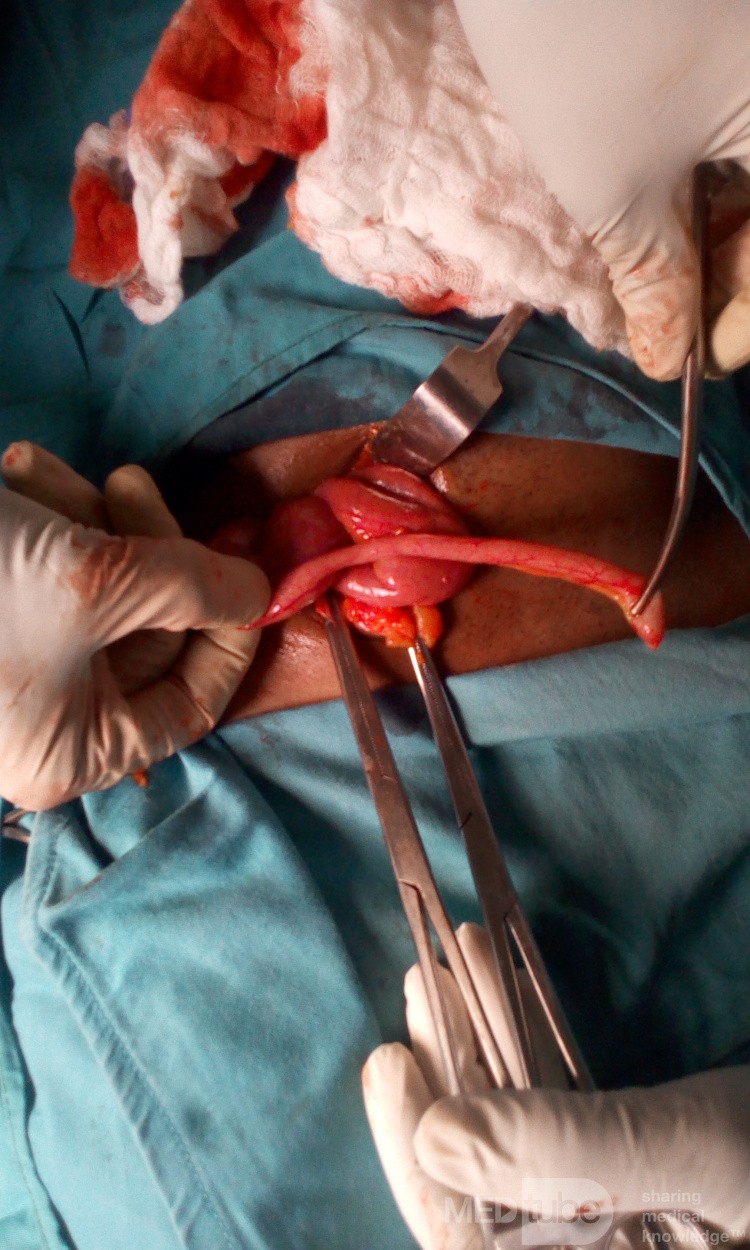 Appendix Extracted