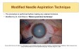 How to Tackle Intumescent Cataract Updates & Novelty