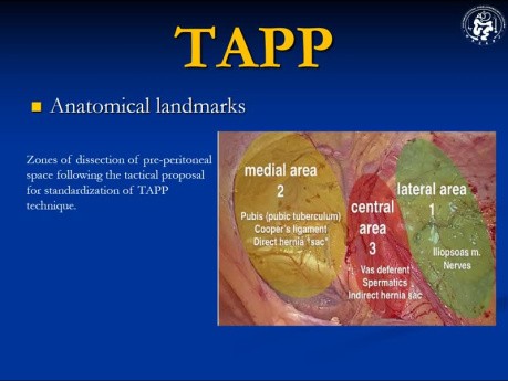 TAPP Hernia Surgery (Lecture)