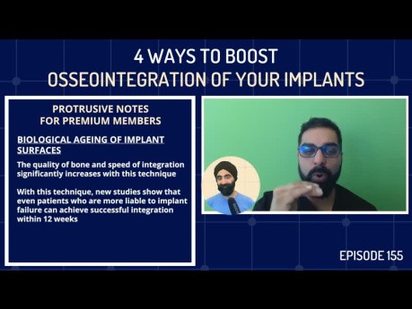 4 Ways to Boost Osseointegration of Your Implants! 