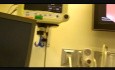 Oval CBD Stone with ERCP in Fluoroscopy