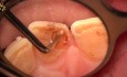 Laser Technology in Conservative Dentistry