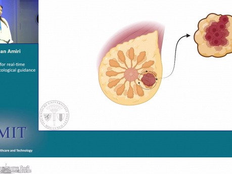 Optical Knife for Real-Time Intra-Operative Oncological Guidance