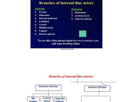 Laparoscopic Internal iliac Artery Ligation for Dysfunctional Uterine Bleeding