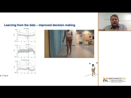 Do we need motion analysis in orthopaedic surgery? - T. Dreher