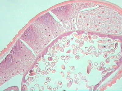 Trichuris Trichuris (whipworm) (13 of 19)
