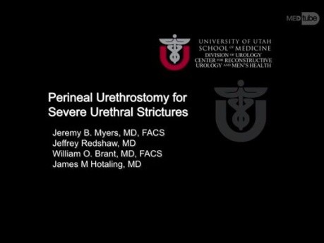 Perineal Urethrostomy