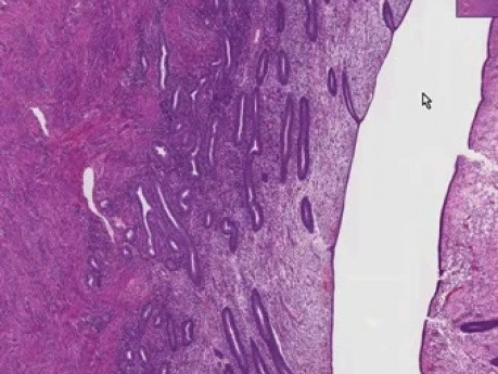 Proliferative Endometrium - Histology