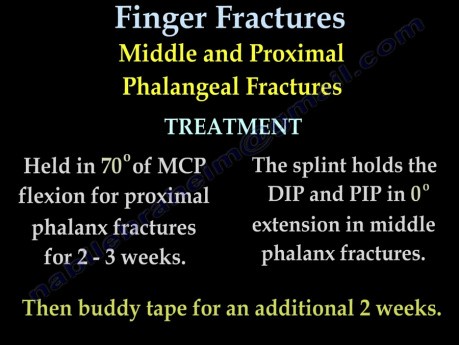 Metacarpal and Finger Fractures - Video Lecture
