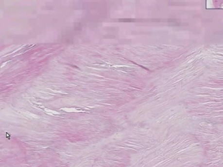 Disk - Histology