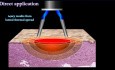 Safe Use of Electrosurgery - an Overview