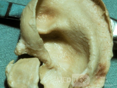 The Auricular Cartilage