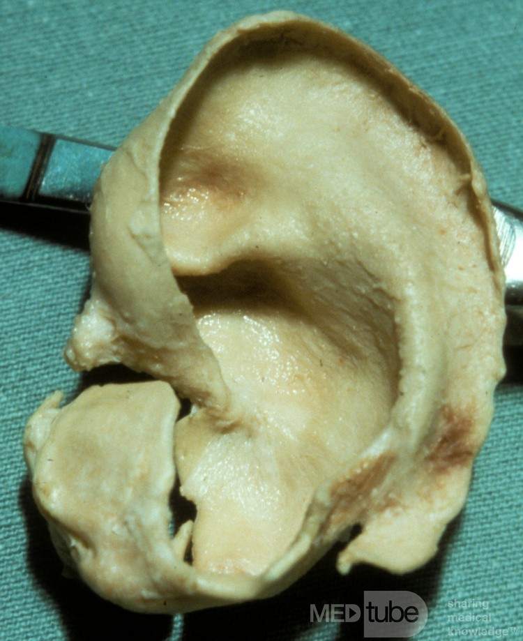 The Auricular Cartilage