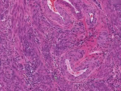 Uterus - Histology