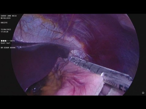 bariatric