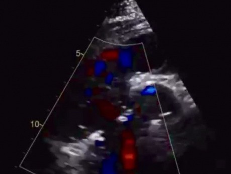 9. Echocardiography Case - What You See?
